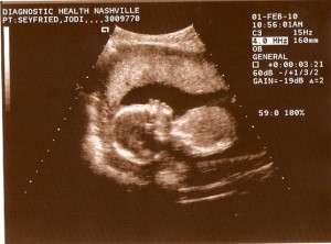 babyseyfried18weeks11